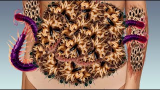 ASMR Deep cleaning 2d animation treaent How to removed dog ticks maggots worms infested bally178 [upl. by Nerret]