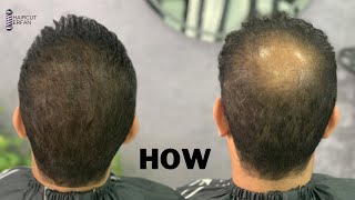 The best hairstyles for thin hair  Correct use of hair toppic [upl. by Vachel874]