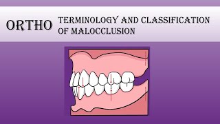 Ortho  Terminology and classification of malocclusion Part 2 [upl. by Winthrop910]