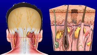 Swollen Occipital Lymph Node Causes And Treatment [upl. by Ultun]