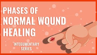 Phases of Normal Wound Healing [upl. by Noraha]