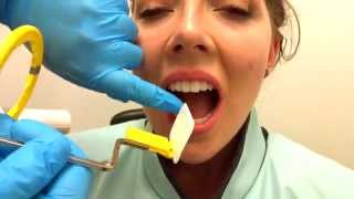 How to Take Periapical Radiographs [upl. by Aras]