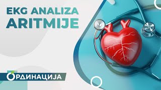 Tumačenje EKG analize i borba protiv aritmija  RTS ordinacija [upl. by Llertnahs]