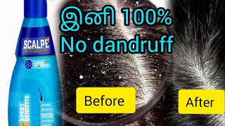 தமிழில் best anti dandruff shampooScalp Plus Anti dandruff shampoo honest review [upl. by Tjader]