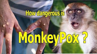 What is monkeypox and how do you catch it  How do you catch it [upl. by Gwenora]