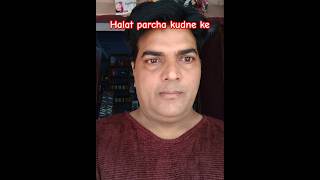 Halat pahad se kudne Kecomedy comedyfilms funny [upl. by Rahmann881]