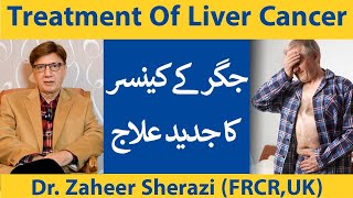 Liver Cancer Treatment By Top Interventional Radiologist Dr Zaheer Sherazi  Jigar Ky Cancer Ka Ilaj [upl. by Pros]