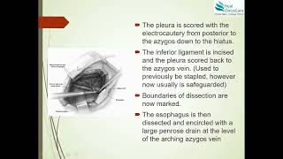 Open Ivor Lewis Esophagectomy  Surgical Steps [upl. by Wain]