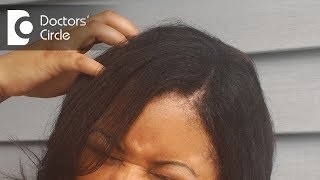 Reasons for itchy scalp and how to treat it  Dr Rasya Dixit [upl. by Paxton]