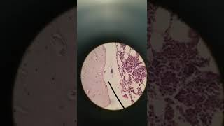 Bone decalcified histology [upl. by Aiuqat]