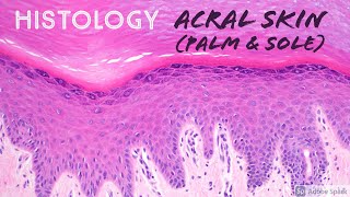 Skin Histology Acral Skin aka glabrous skin of palm of hand amp sole of foot [upl. by Eseenaj]