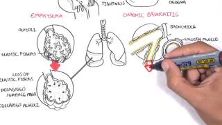 Chronic Obstructive Pulmonary Disease Overview types pathology treatment [upl. by Sausa]