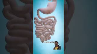 A doctor Gastric bypass surgery  howtoavoidbypasssurgery anatomy biology [upl. by Allimaj511]