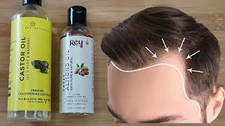 Castor Oil and Almond Oil for Hair Growth [upl. by Derriey]