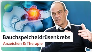 Bauchspeicheldrüsenkrebs Warnzeichen frühzeitig erkennen  Diagnose amp Therapie [upl. by Letsirc]