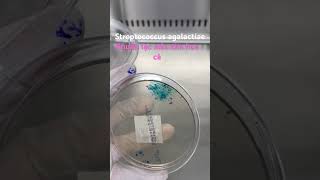 Bạn có biết rằng việc xét nghiệm dịch âm đạo giúp phát hiện Streptococcus agalactiae GBS lab [upl. by Bianca]