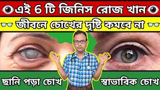 🔥এই 6টি জিনিস রোজ খান আজীবন চোখের দৃষ্টির কোন সমস্যাই হবে না।6 Vitamins That Keep Your Eyes Healthy [upl. by Gievlos]