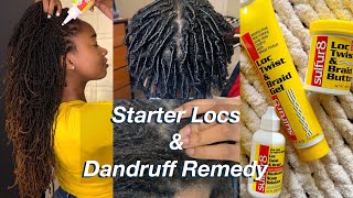 Getting Rid of Dandruff amp Starting Dreadlocs with Sulfur8  retwisting amp my dandruff struggle [upl. by Nowujalo]