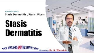 Stasis Dermatitis and Ulcers  Causes Diagnosis Symptoms Treatment Prognosis [upl. by Clayborn]