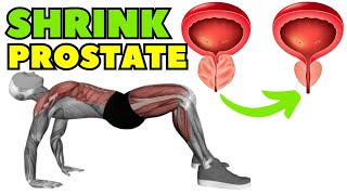 Best Exercise To Shrink Enlarged Prostate Home Remedy [upl. by Nnagrom]