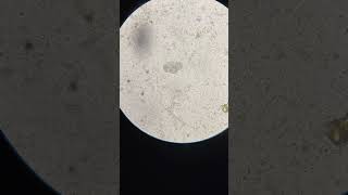 Hookworm egg in dogsAncylostoma caninum parasite dogs worms [upl. by Ursas]