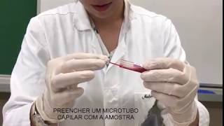 MENSURAÇÃO DO HEMATÓCRITO E PROTEÍNAS PLASMÁTICAS [upl. by Cris843]