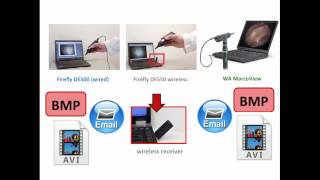 Video Otoscope Comparison [upl. by Ikcim]