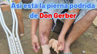 asi esta la pierna podrida de Don Gerber [upl. by Aivartal]