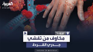 الصحة العالمية تستعد للمزيد من الإصابات بجدري القردة [upl. by Charline]