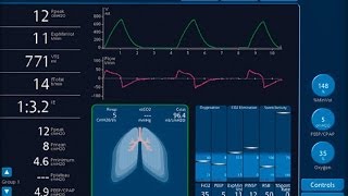 How does a ventilator works [upl. by Susejedairam]