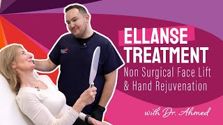 Non Surgical Face amp Hand Rejuvenation  Ellanse Treatment with Dr Ahmed [upl. by Aratahs250]