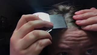 FIRST TIME SCRAPING SCALP USING LICE COMB  battling scalp psoriasis and extreme dandruff [upl. by Nyrret918]