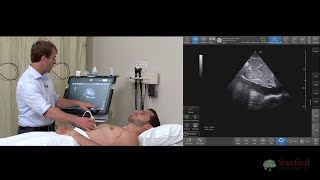 Examining the Inferior Vena Cava IVC with Point of Care Ultrasound POCUS [upl. by Kacey700]