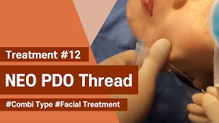 NeoGenesis Thread Series PDO Combi Type Facial Treatment [upl. by Akerdal]