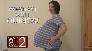 Quintuplet Mom at 33 Weeks and 2 Days [upl. by Pillyhp]