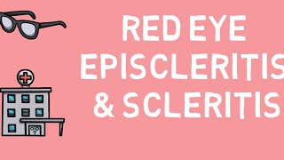 Red eye Episcleritis and Scleritis [upl. by Rego]