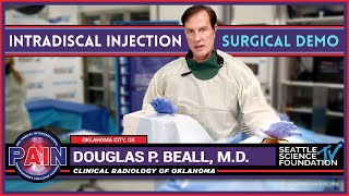 Intradiscal Injection  Douglas P Beall MD [upl. by Lanevuj582]