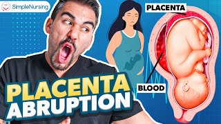 Placental Abruption Symptoms Causes Nursing Interventions  NCLEX Tips [upl. by Devinne]