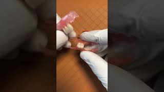 flexible denture prosthesis thinner and smaller size confortable homemade shortsyoutube viral [upl. by Scholem]