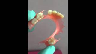 flexible denture made perfectly for you [upl. by Rodnas]