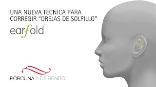 Nueva técnica para corregir las orejas de soplillo Earfold [upl. by Lleinnad]