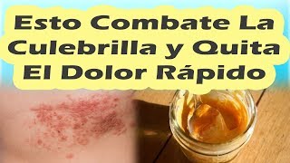 ESTO COMBATE LA CULEBRILLA Y QUITA EL DOLOR RÁPIDAMENTE Remedios Caseros Para La Culebrilla [upl. by Adiari291]