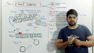 Diabetes mellitus type 1 and Type 2 [upl. by Alya]