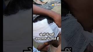 पट्टी कैसे किया जाता है How to Head Bandage hospital medical doctor patient shortvideo [upl. by Darn]