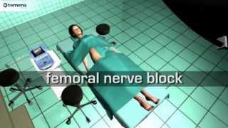 Femoral Nerve Block [upl. by Haisoj501]