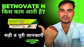 betnovate n lagane se kya hota hai  betnovate n skin cream ke fayde [upl. by Ardussi376]