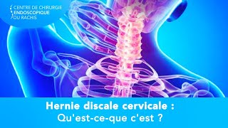 HERNIE DISCALE CERVICALE  Questceque cest [upl. by Kowalski]