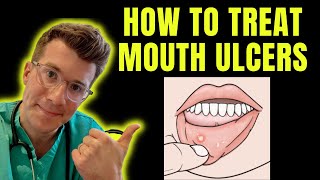 How to recognise and treat Mouth Ulcers getting rid of canker sores  Doctor ODonovan explains [upl. by Drusie797]