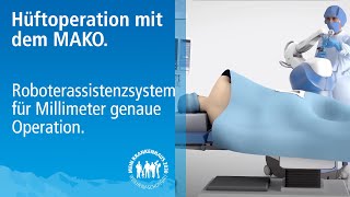 MAKO Knie und HüftOP mit Roboter auf den Millimeter genau  Dr Löffler erklärt Robotersystem [upl. by Llennol487]