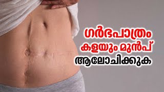 ഗർഭപാത്രം കളയും മുൻപ് ആലോചിക്കുക  Uterus Removal  Uterus Problem [upl. by Rora]